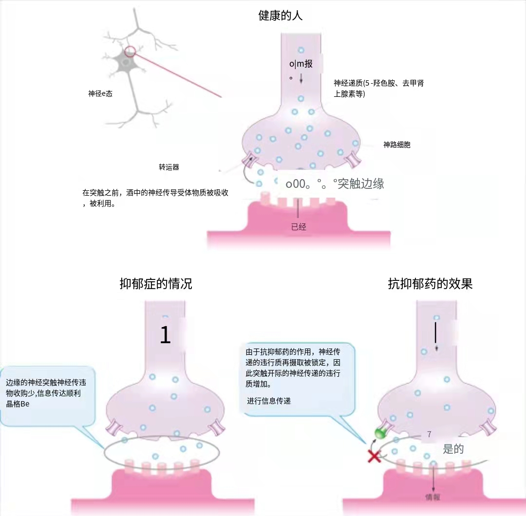 抑郁的机制